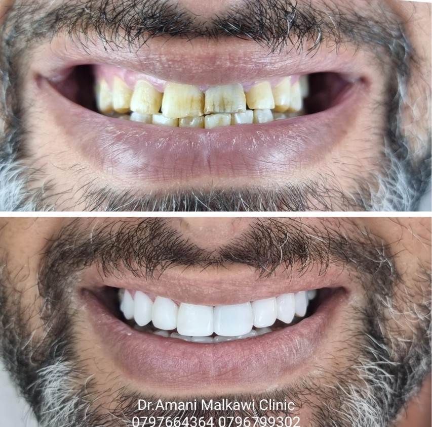 Cosmetic Dentistry